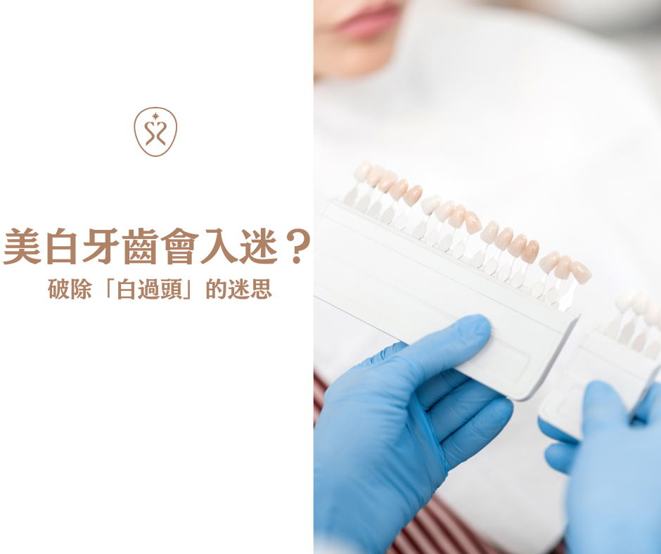 美牙迷思四：美白牙齒會上癮？破除「白過頭」的迷思